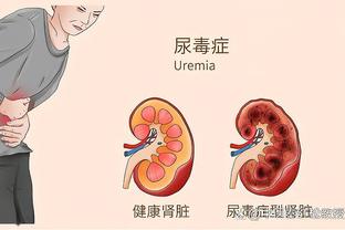 国米伤情：邓弗里斯和德弗里单独训练，帕瓦尔可能进比赛名单